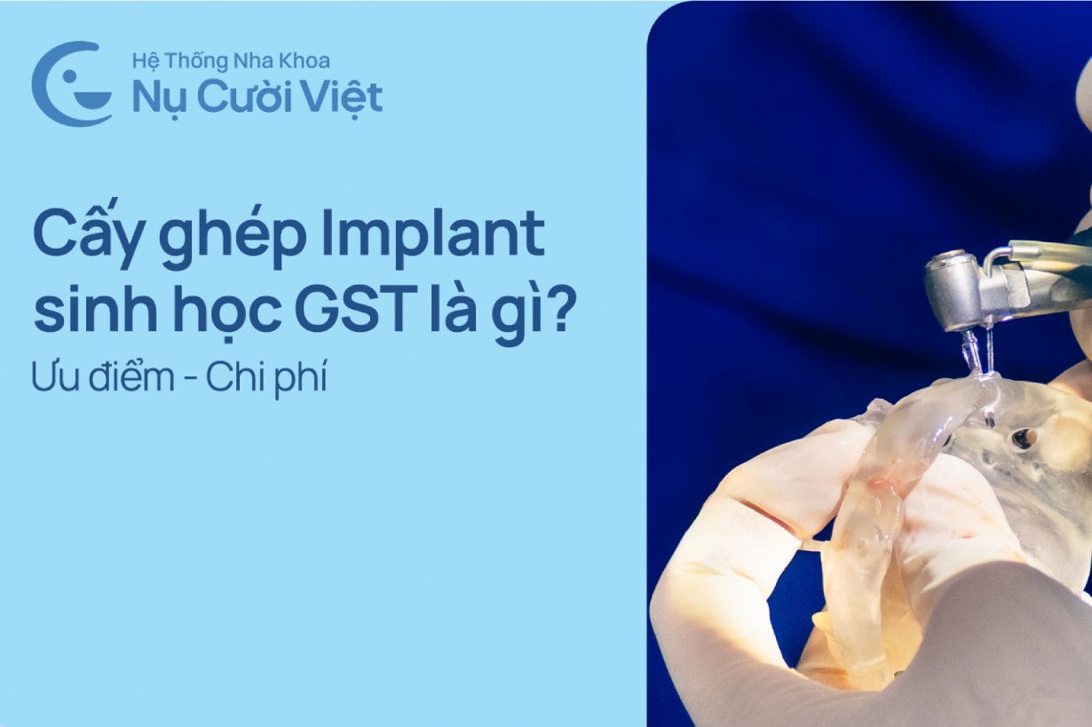 Cấy ghép implant sinh học GST là gì? Ưu điểm và chi phí ra sao?