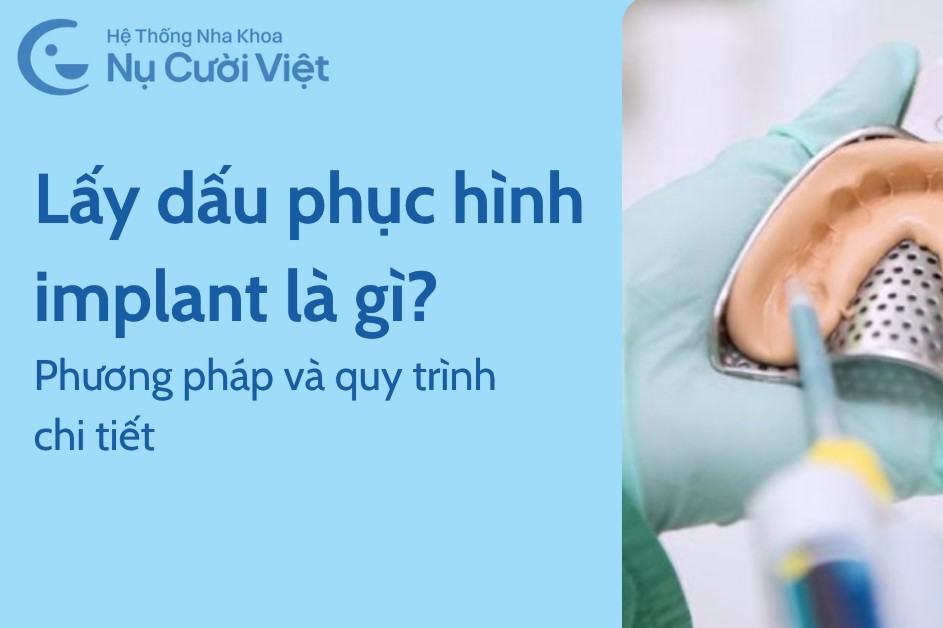 Lấy dấu phục hình trên implant là gì? Phương pháp và quy trình