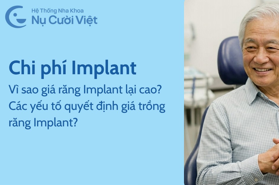 Vì sao giá của răng Implant lại cao? Các yếu tố quyết định giá trồng răng Implant