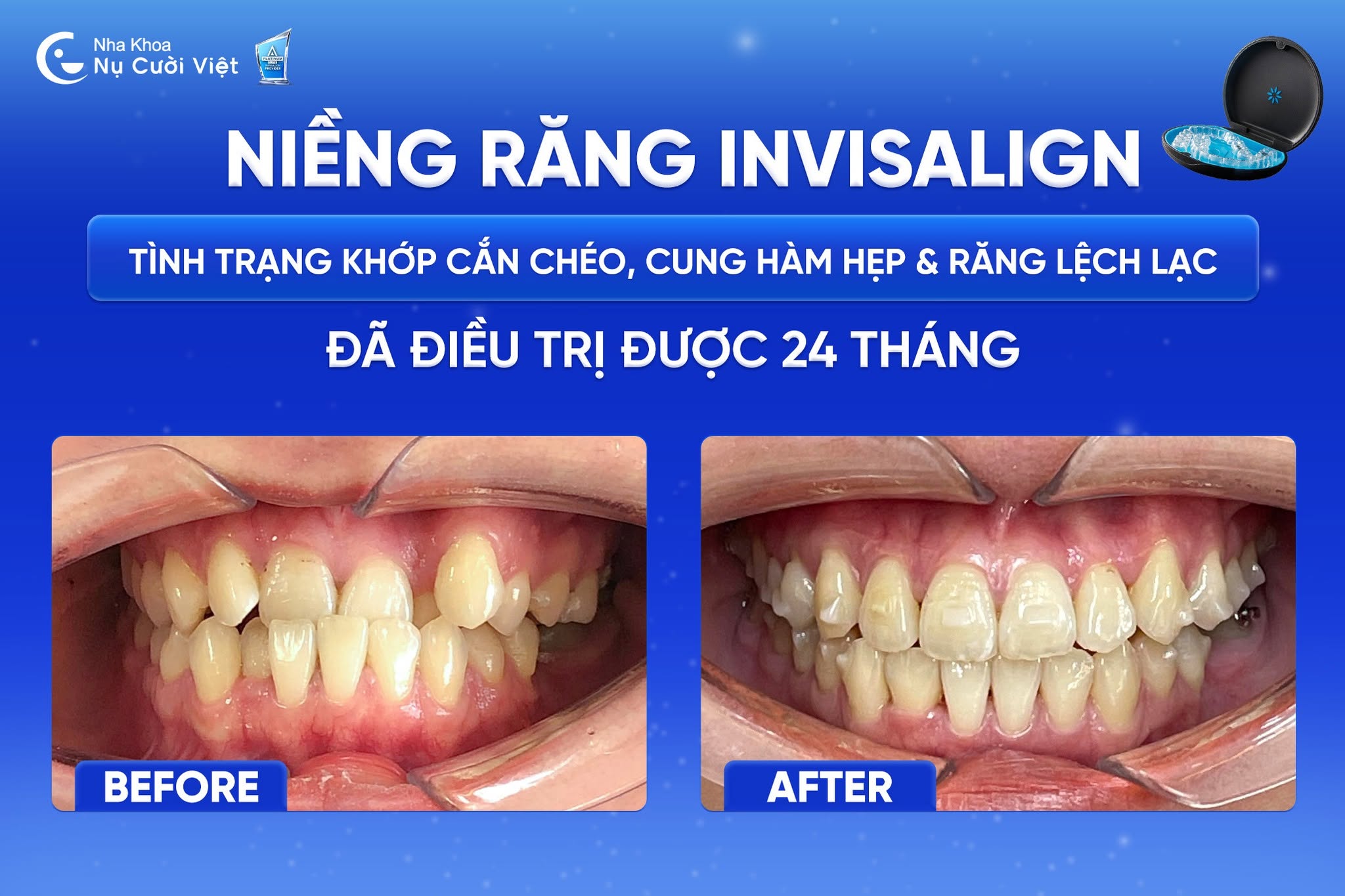 Nụ Cười Việt