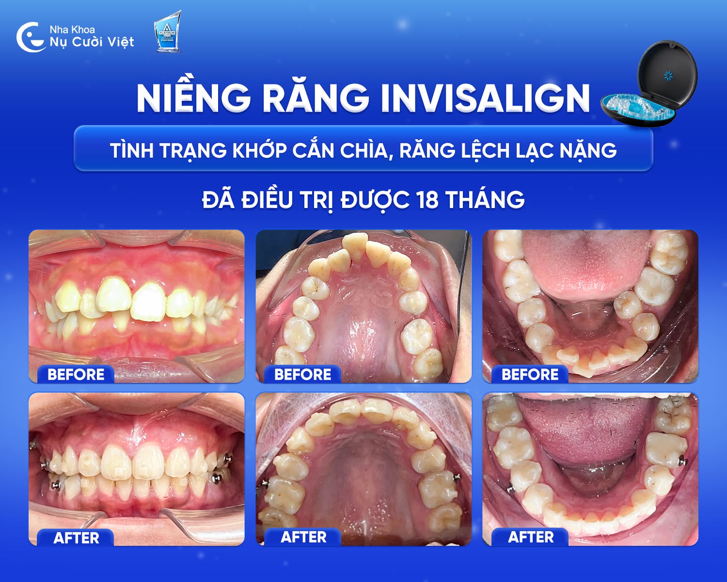 Nụ Cười Việt