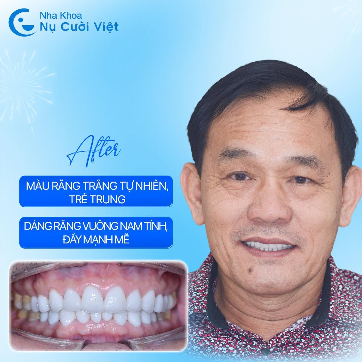 Nụ Cười Việt