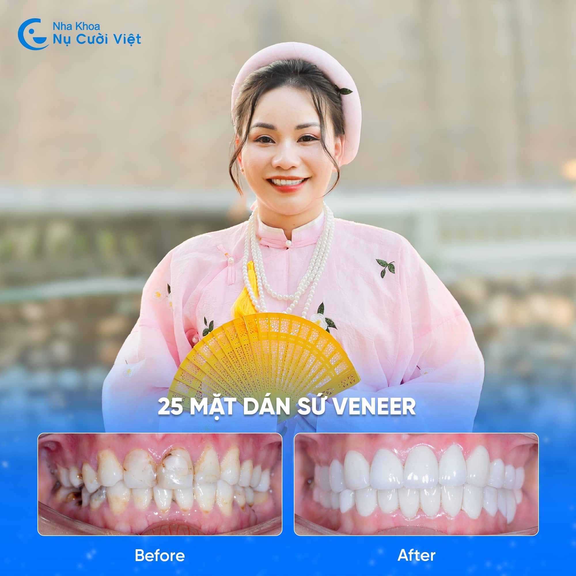 Nụ Cười Việt