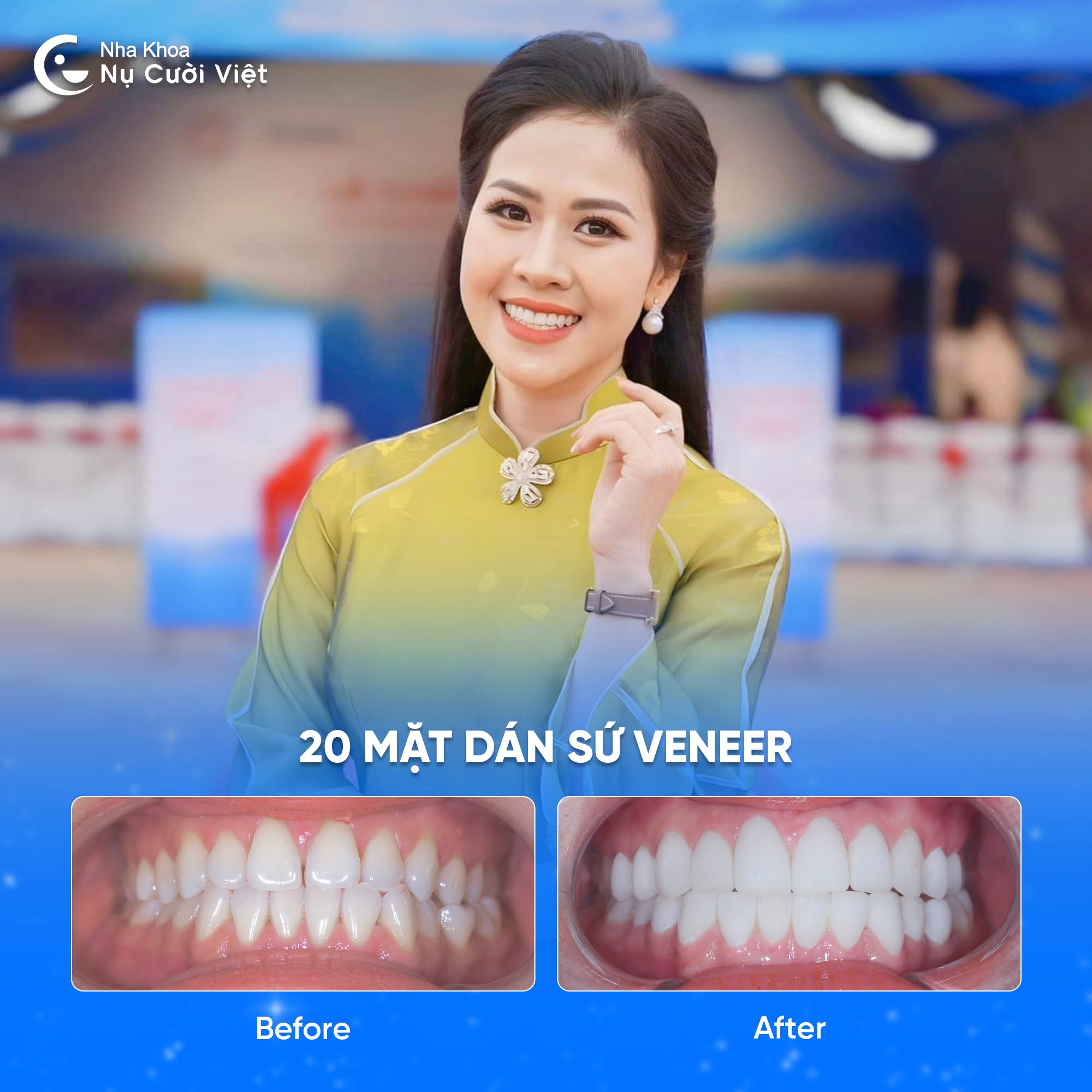Nụ Cười Việt