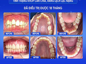 Nụ Cười Việt