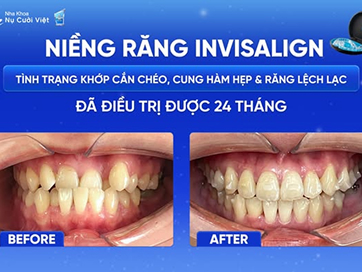Nụ Cười Việt
