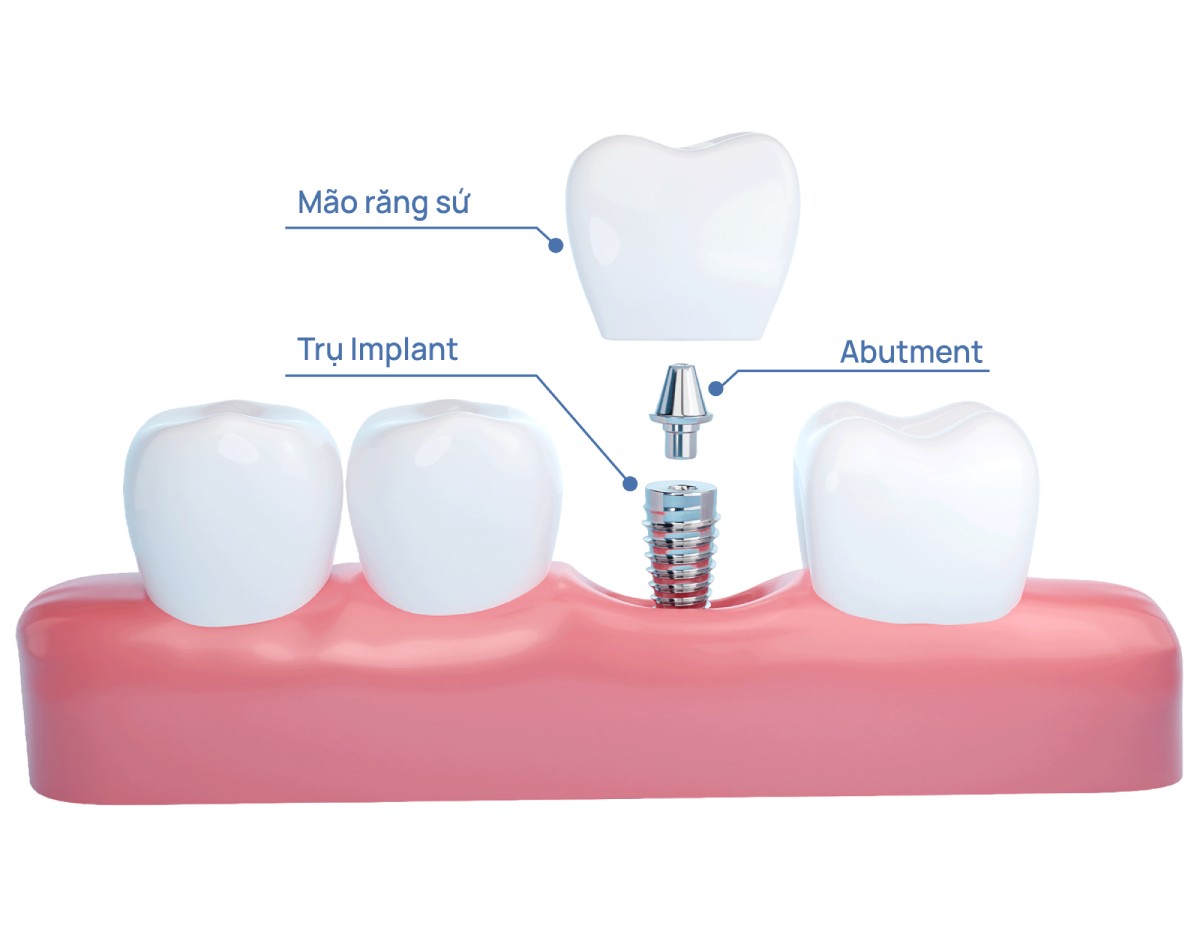 Nụ Cười Việt