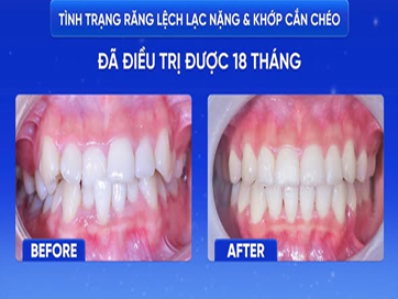 Nụ Cười Việt