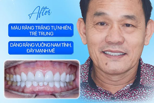Nụ Cười Việt