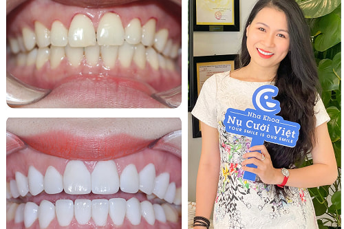 Nụ Cười Việt