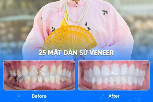 Nụ Cười Việt