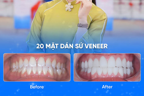 Nụ Cười Việt