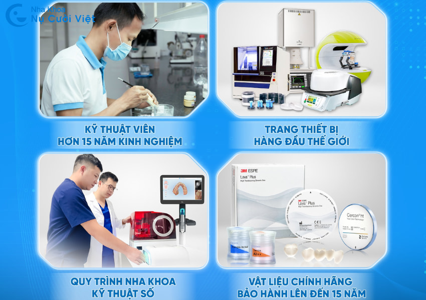 dán sứ veneer tại nha khoa Nụ Cười Việt