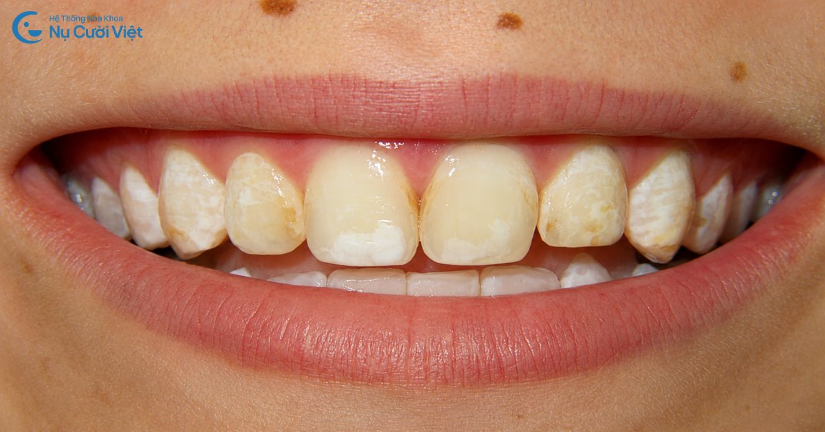 Nụ Cười Việt
