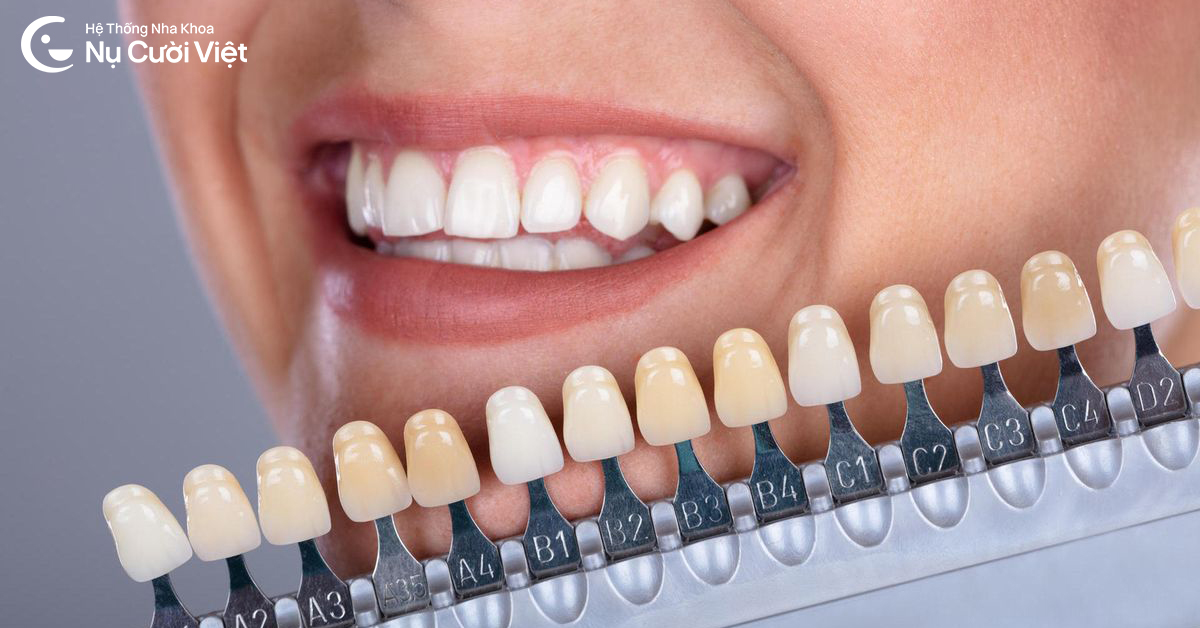 LÀM RĂNG SỨ CÓ BỊ XUỐNG MÀU KHÔNG? TIPS GIỮ RĂNG SỨ LUÔN TRẮNG SÁNG, BỀN LÂU