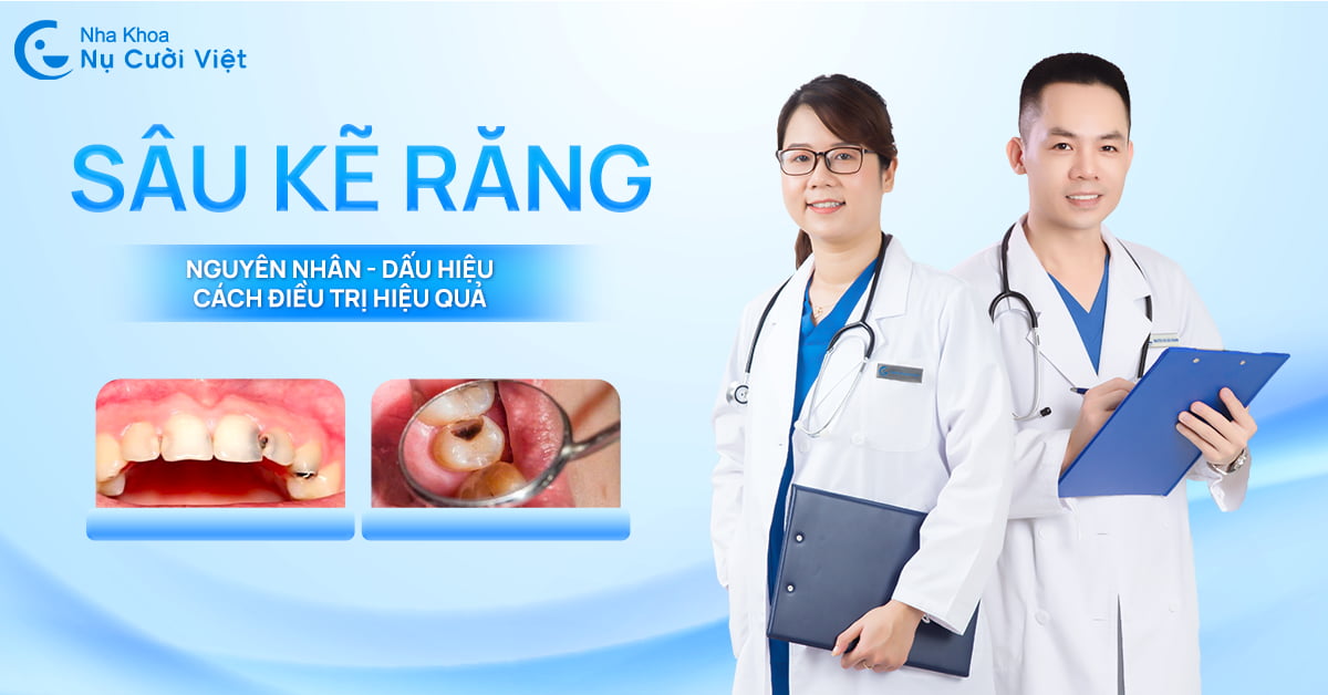 Sâu kẽ răng: Nguyên nhân, dấu hiệu và cách điều trị hiệu quả